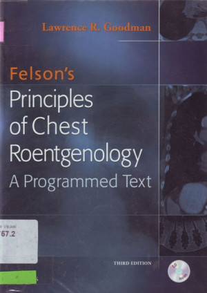 Image of Principles of Chest Roentgenology : A Programmed Text